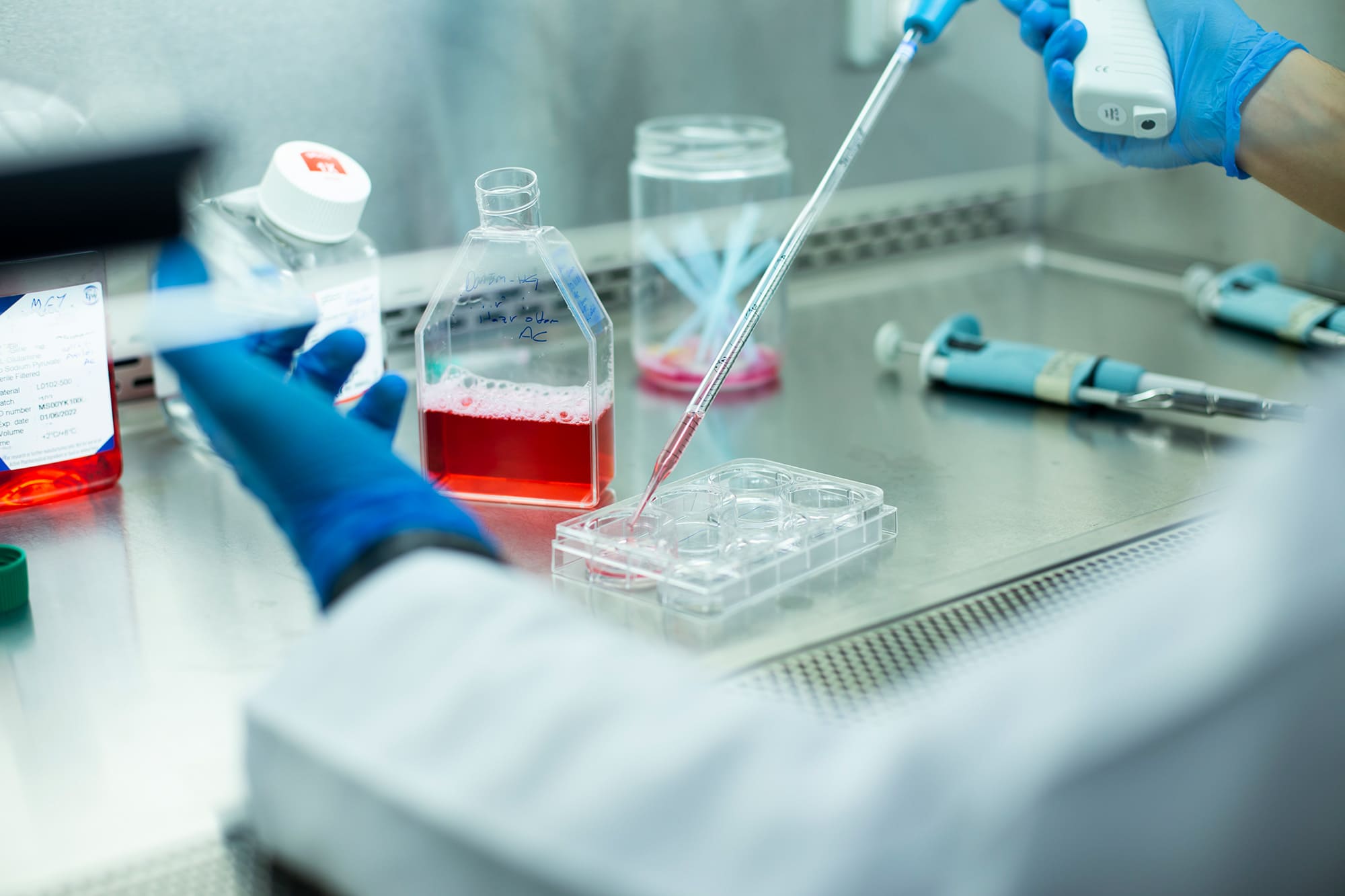 アレルゲンの測定